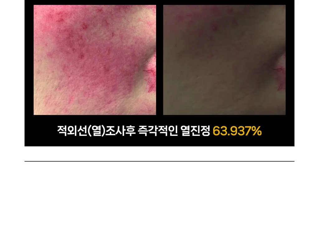[퀵-밀착 특허 콜라겐] 더마픽스 페이턴트 퍼포먼스 리얼콜라겐 5매 (3종 택1) 상세페이지 49